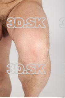 Knee texture of Koloman 0001